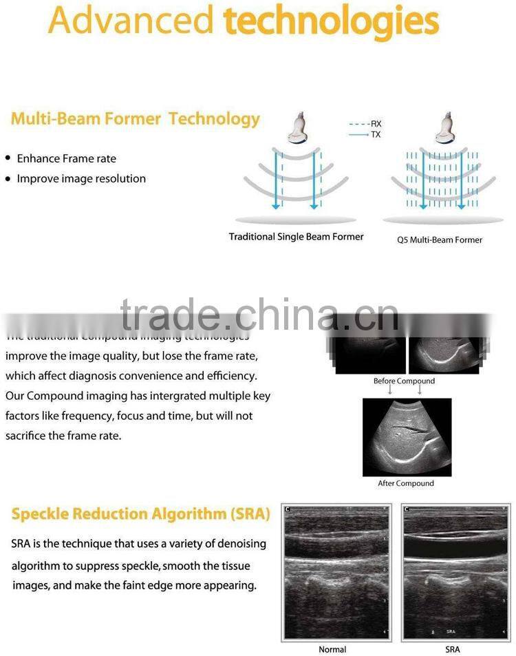 Portable Doppler Ultrasound Machine