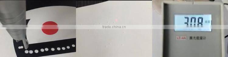 ce approved painless 1320nm 1064 nm 532nm gentle long pulse pigments tattoo removal varicose veins laser treatment q switch nd