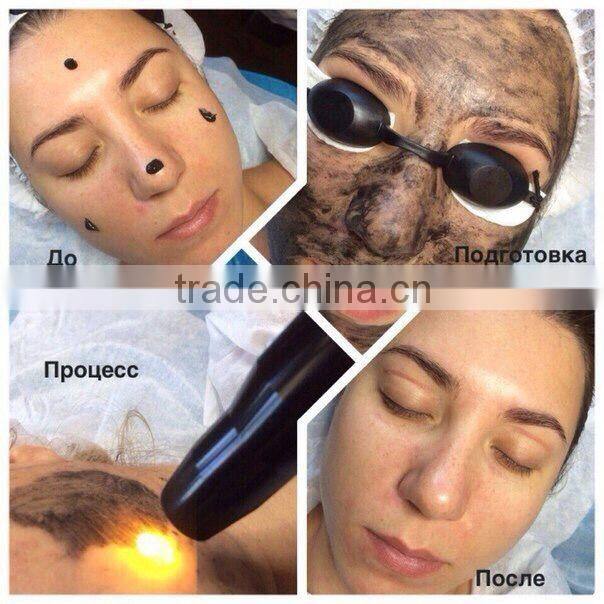 532/1064/1320nm q switched nd yag laser tattoo removal beauty salon equipment