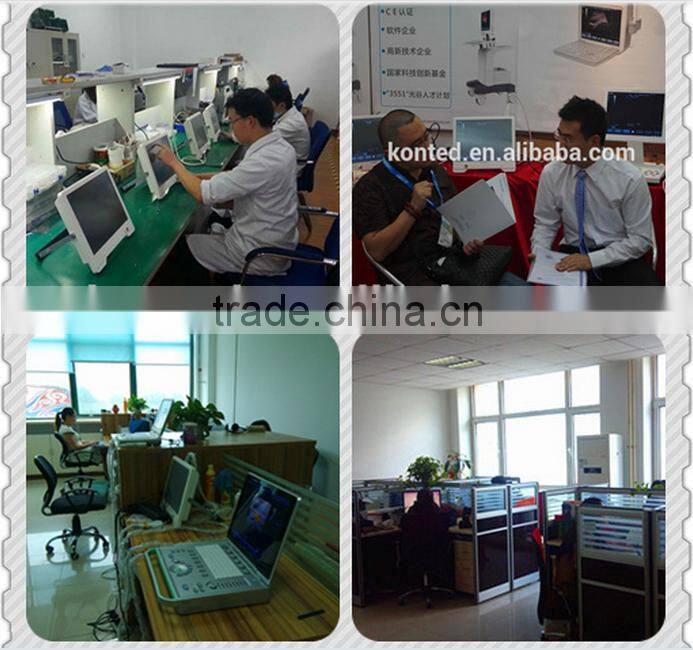 Konted Handheld Vein Viewer Price Transiluminador Ultralight For Vein