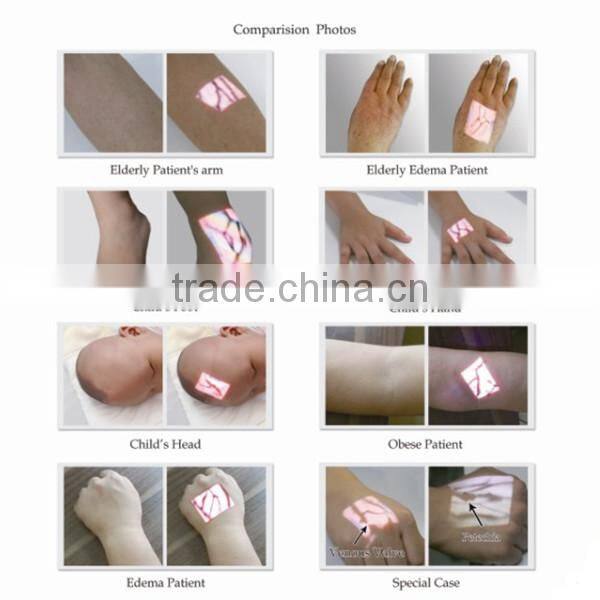 medical hospital or clinic find blood veins projection vein detector