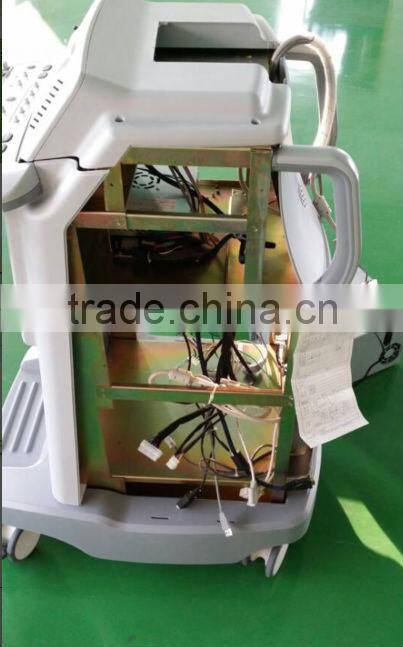 iSpark 380 High Performance Mature Technology medical factory mehinery