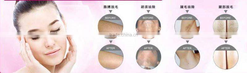 permanent hair removal aesthetics machine for plastic surgery hospital