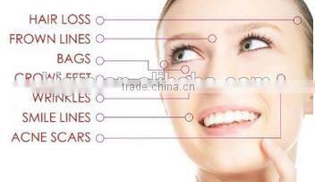 Hot Sale 180 Needles Eye Derma Roller