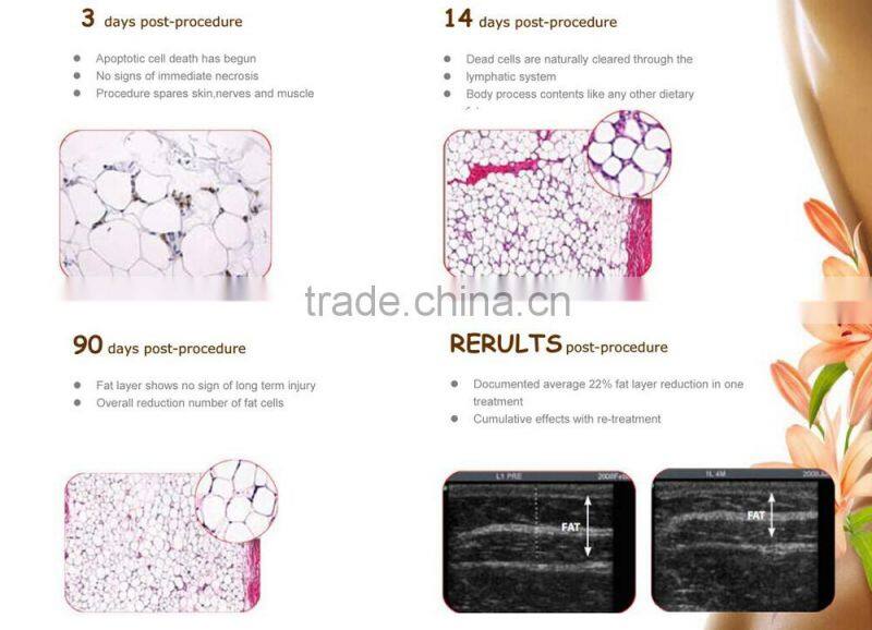 Antifreeze membranes multifunctional criolipolisis / cryolipolysis antifreeze membrane for freeze fat machine