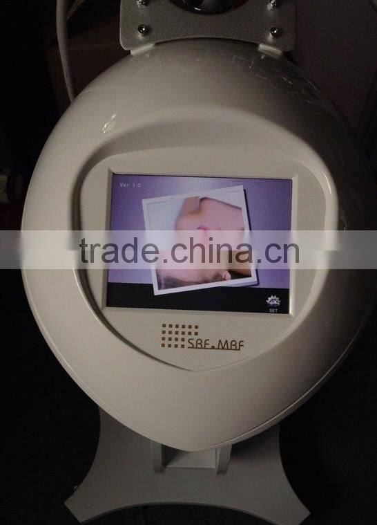 2014 newest rf machine with high-tech humanized design for skin lifting