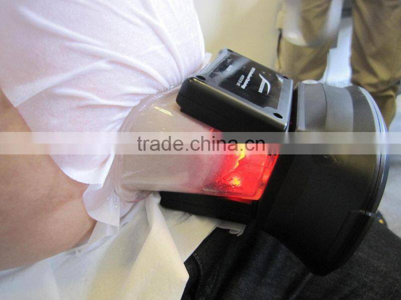 guangzhou BL CE approved smart cryolipolysis fat freezing machine