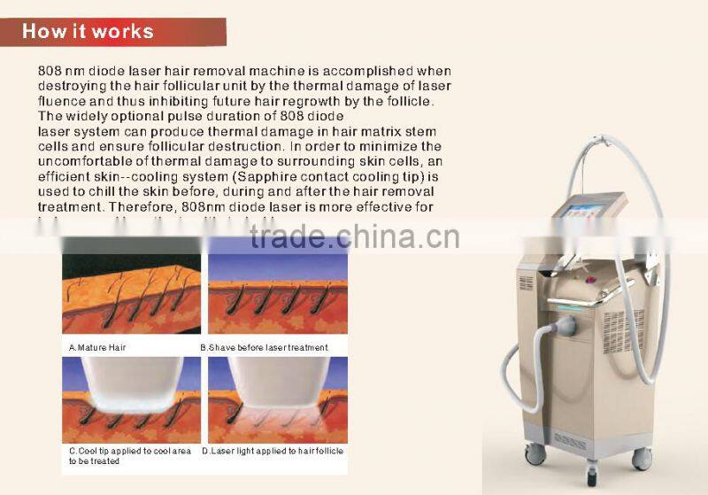 Laser Hair Epilation Diode Laser