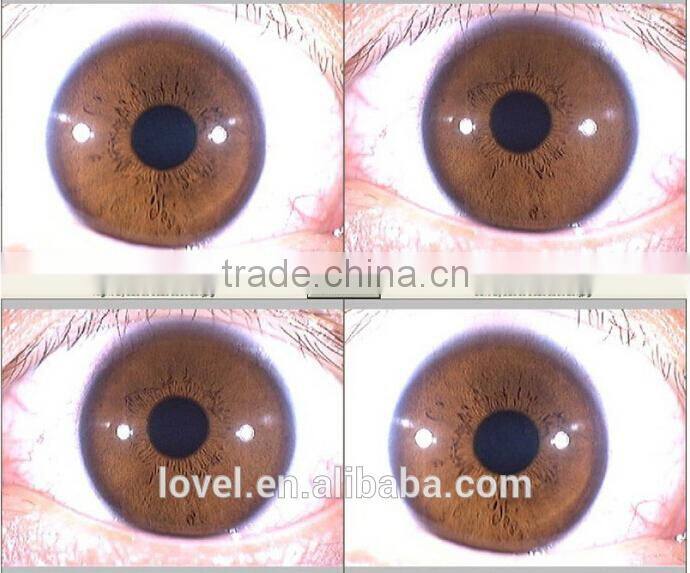 new products looking for distributor magic mirror skin scanner analyzer 5.0 MP High Resolution CCD USB skin scope