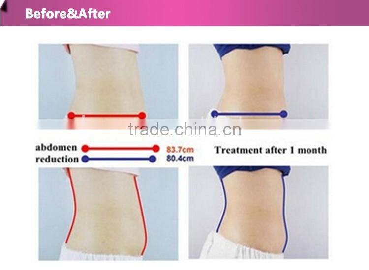 cool slimming machine/vibration slimming machine/cool tech fat freezing slimming machine