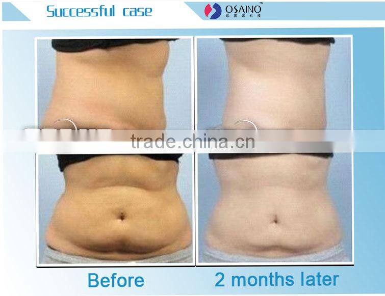 Customer Good Feedback Beauty Machine Vacuum Kryolipolyse