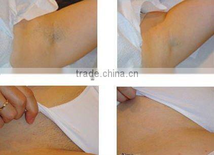 China supply CE P003 long pulse Nd yag laser for Skin Rejuvenation