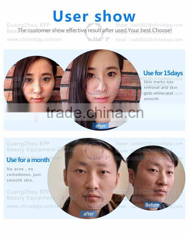 Beauty salon skin peeling diamond tips for hydro dermabrasion water oxygen jet peel machine