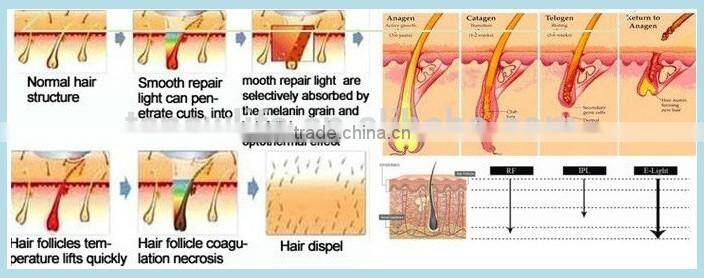 NL-IPL809 BEST! ipl laser machine price/hair removal skin rejuvenation(CE)