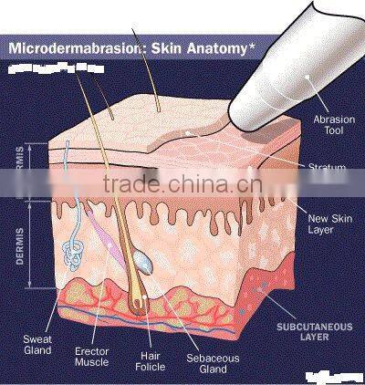 RF Mesotherapy body slimming machine CE
