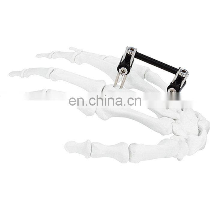 CE & ISO Marked Mini Fragment External Fixator (Finger and Palm) Surgical Instrument