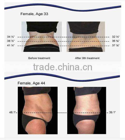 Guangzhou manufactuer ultrasound cavitation weight loss beauty equipment