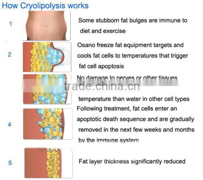 Best products cryolipolysis cool shape machine/portable cryolipolysis machine beco