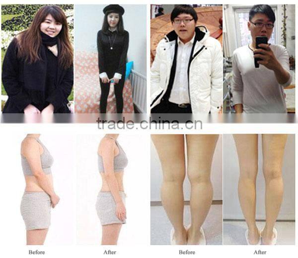Non-invasive RF Vacuum 40K cavitation machine for slimming