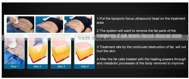 Safety ultrasound slimming weight loss fat reduction liposunic machine price