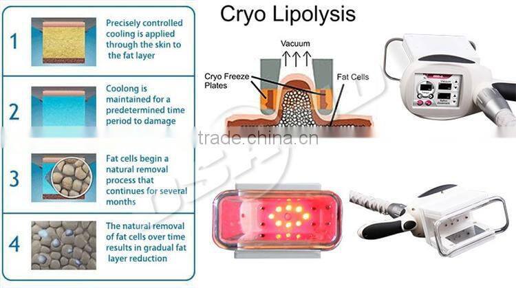 Hottest portable cryolipolisis machine ultrasonic rf vacuum cavitation machine