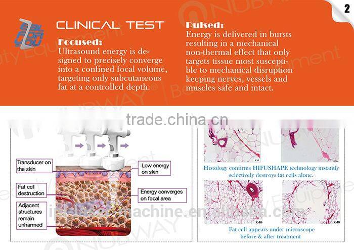liposonix machine High intensity ultrasound slimming machine