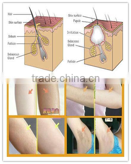 Best effective mini ipl/rf hair removal machine portable with most advanced technology