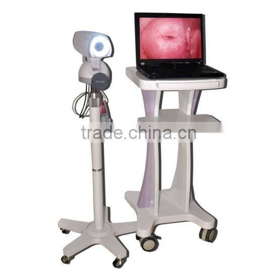 Medical Equipment Portable Digital Camera Vaginoscope Colposcope