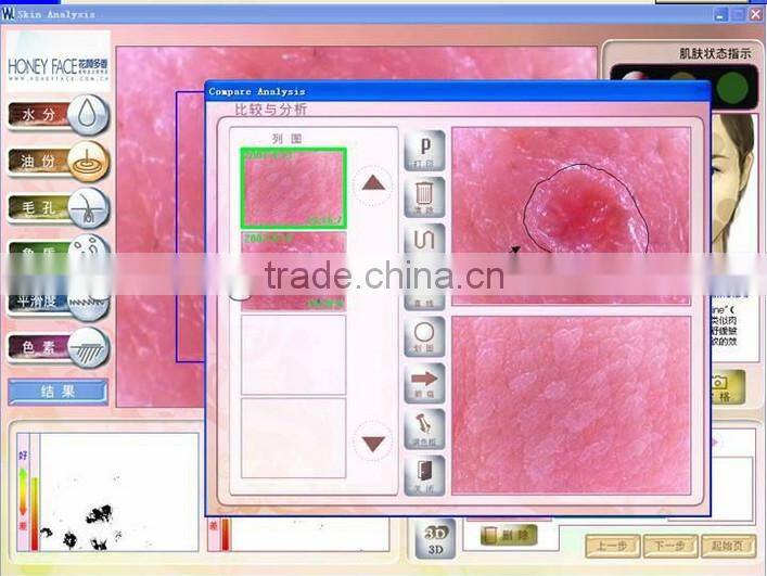 Hot-selling touch screen digital facial skin analyzer beauty machine BD-P006