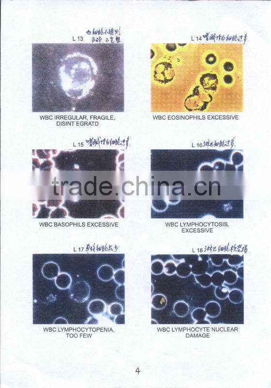 A drop of blood detector(Monocular)