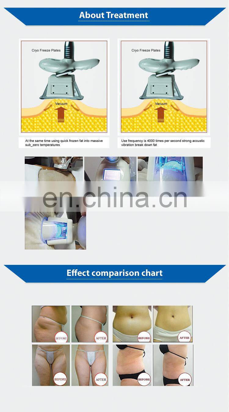 Best price cool tech professional cryo slimming machine /cryotherapy fat freezing device