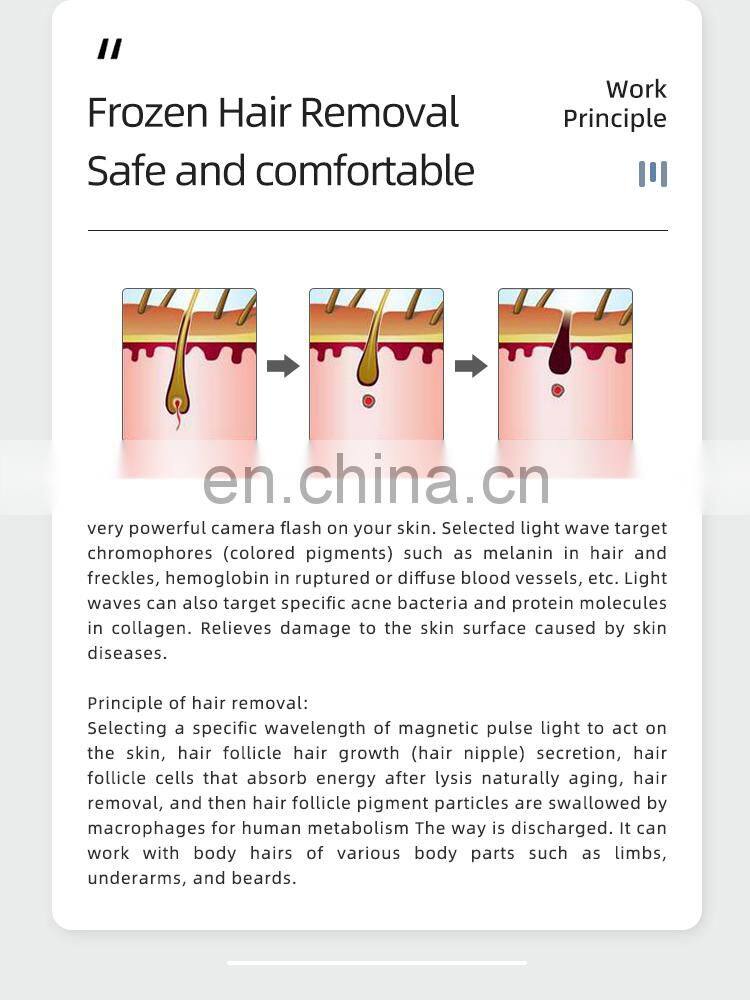 Multifunctional elight+ipl Opt Super Hair Removal skin Rejuvenation Rf E Light Ipl Laser Machine permanent hair removal ipl