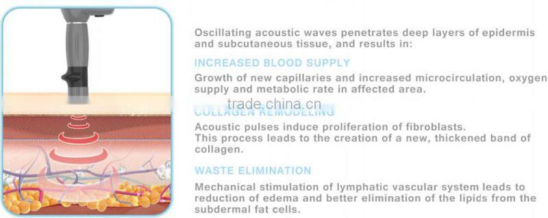 portable beauty system acoustic shockwave for cellulite removal device - ESWT SD