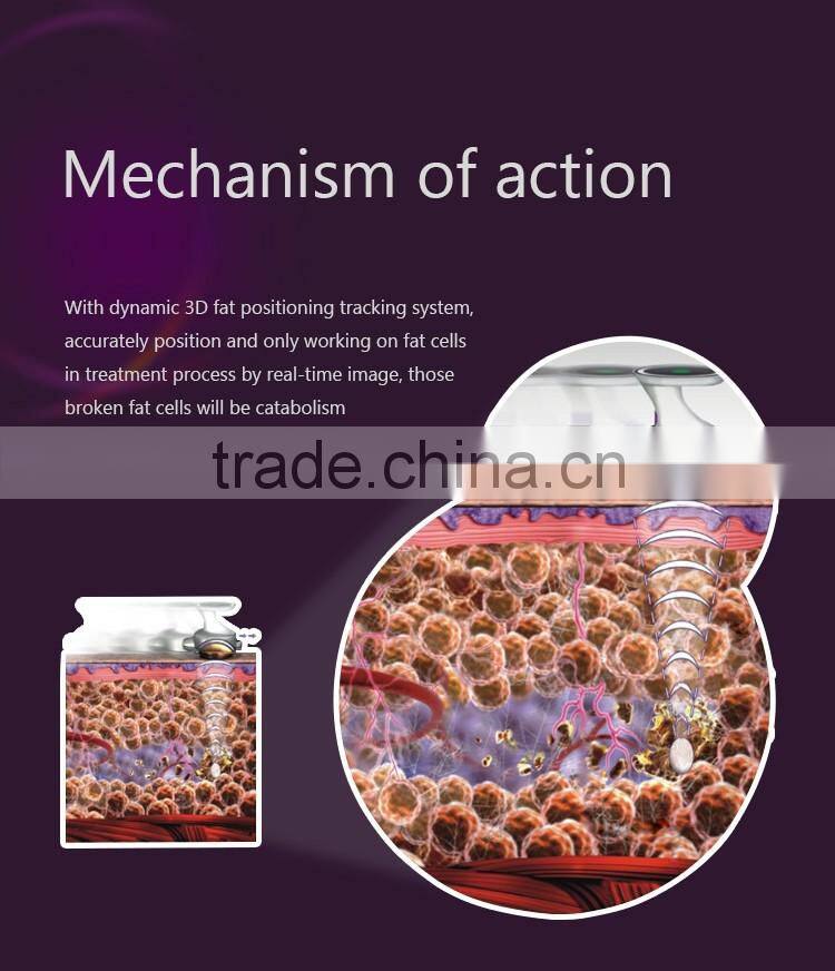 2016 ultrashape hifu body slimming machine / liposonic machine / ultrasonic ultrasound liposuction equipment for weight loss