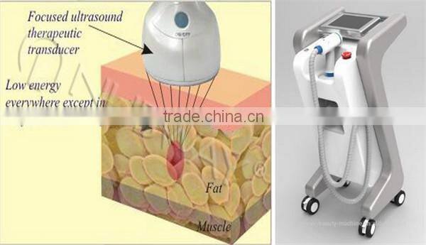 Hot best slimming beauty equipment! Professional Hifushape hifu slimming machine burning laser