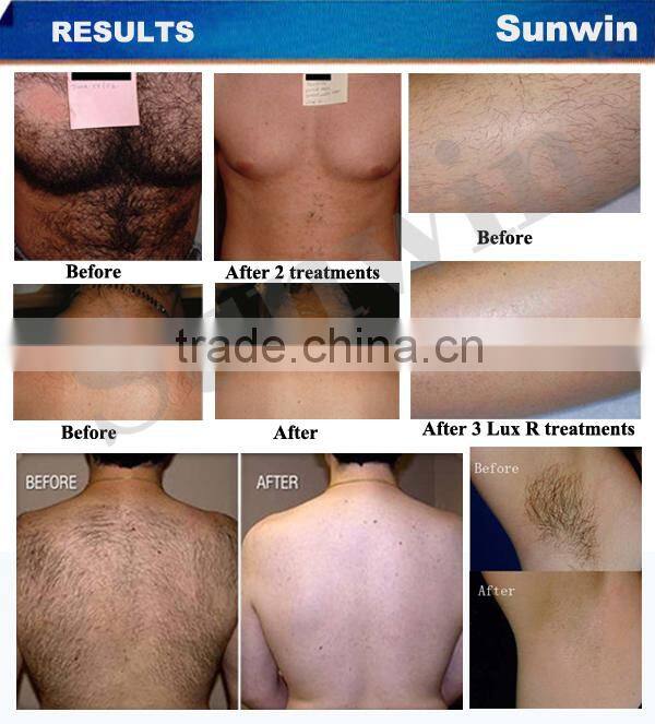 SW-313E Big Promotion / OPT / SHR Technology super hair removal machine IPL SHR