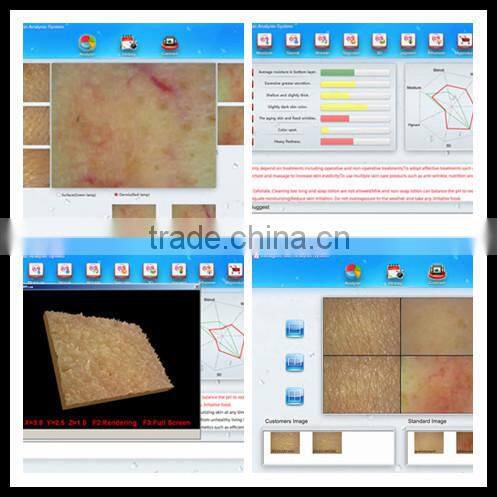 Portable high quality skin scanner/Mini skin and hair scanner
