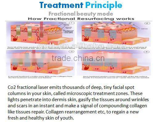 GGLT RF tube CO2 fractional laser vaginal tightening Skin rejuvenation machine price