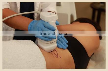 2016 Most advanced High Intensity Focused ultrasound HIFU body slimming lipo hifu machine/ HIFU slimming machine