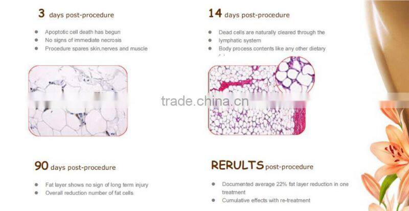 BD06C Portable cryolipolysis fat freeze slimming machine