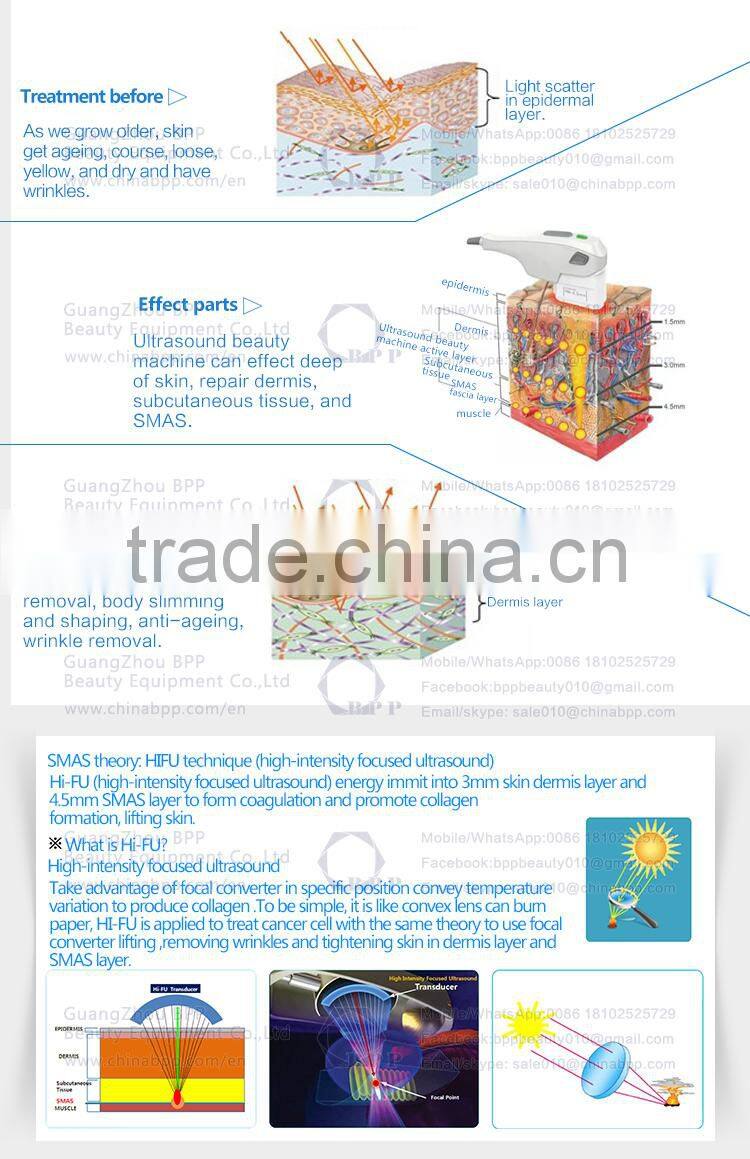 Portable ultrasound HIFU face lift machine A1709