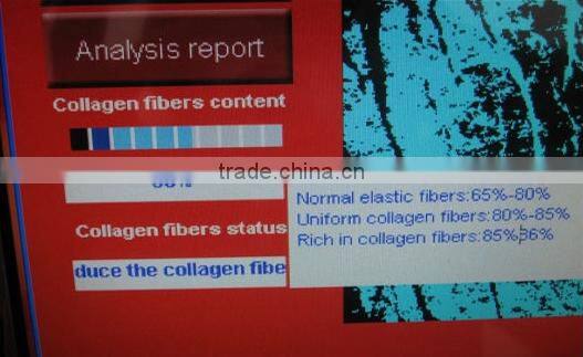 2015 new arrival skin scanner machine best sell facial skin scope analyzer