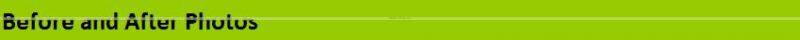 Acne Treatment ipl rf E-light beauty equipment