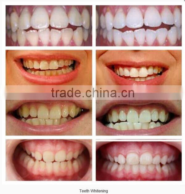 teeth whitening gel with 3ml CP HP or non-peroxide for bleaching tooth
