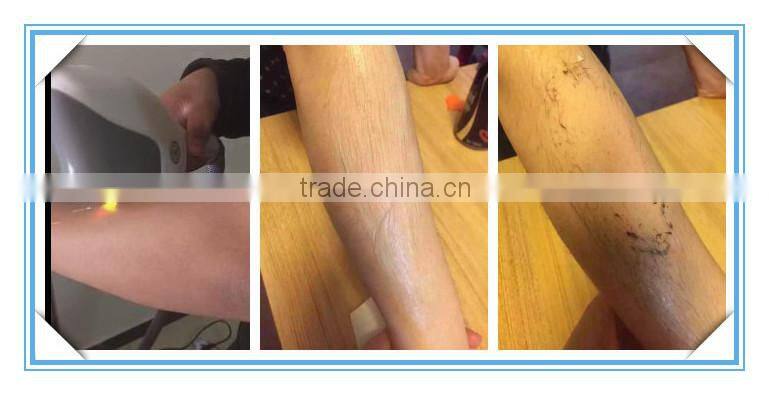 IPL SHR laser hair removal machine with touch screen