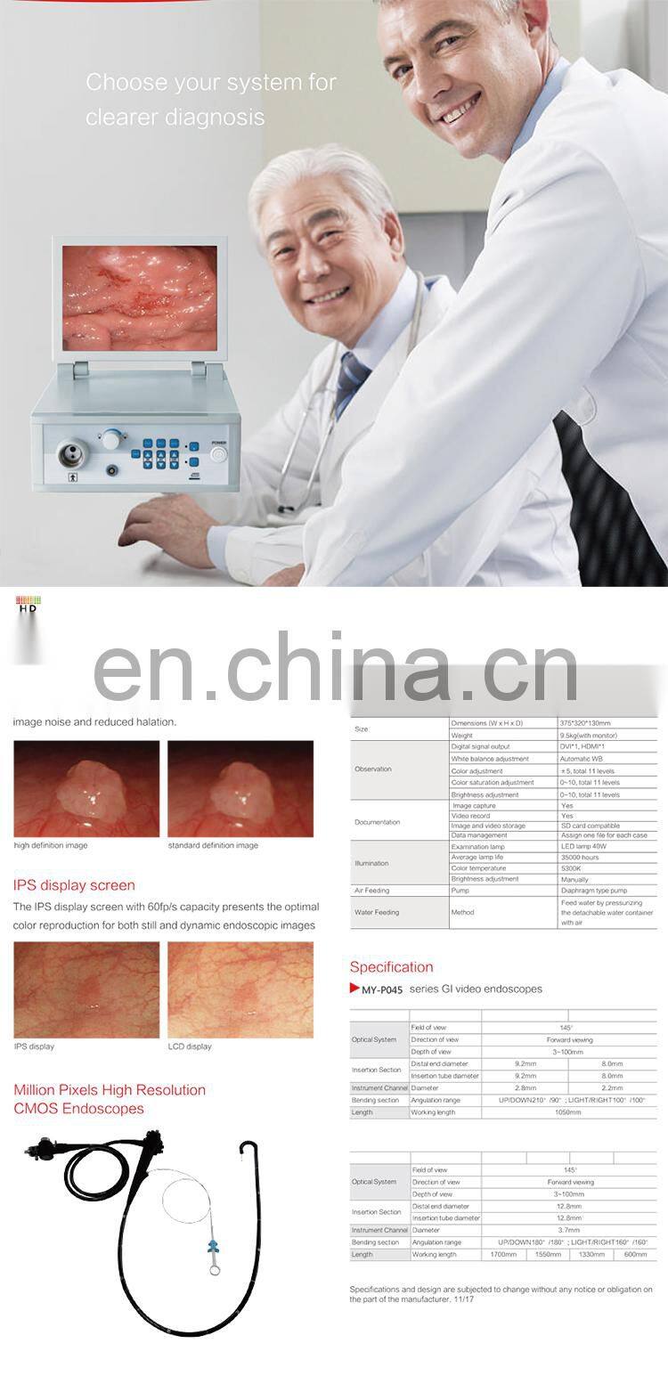 High Resolution Electronic Video Gastroscope And Colonoscope,Medical Equipment Endoscopy System Price With LED Light Source