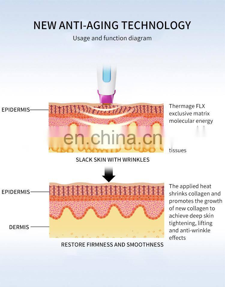 Thermagic FLX tips Skin Rejuvenation Machine Facial Anti Aging RF Beauty Instrument Body Lifting treatment head