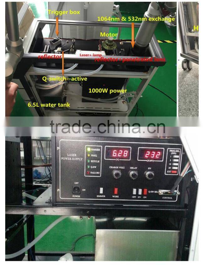 Alibaba Thailand best 1064nm 532nm q switched nd yag laser machine for tattoo removal