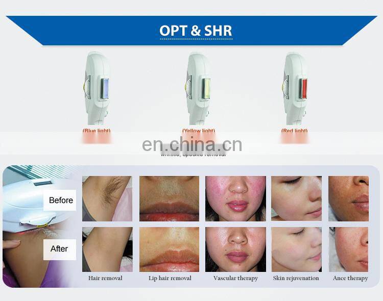 Best Selling Multifunction ipl+rf shr Hair Removal Beauty Salon Machine