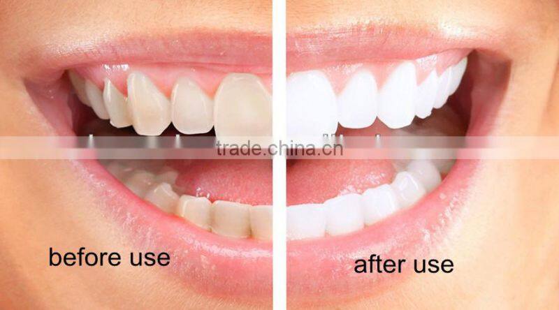 2ml/5ML Teeth Whitening Pen, replace Teeth Whitening Gel